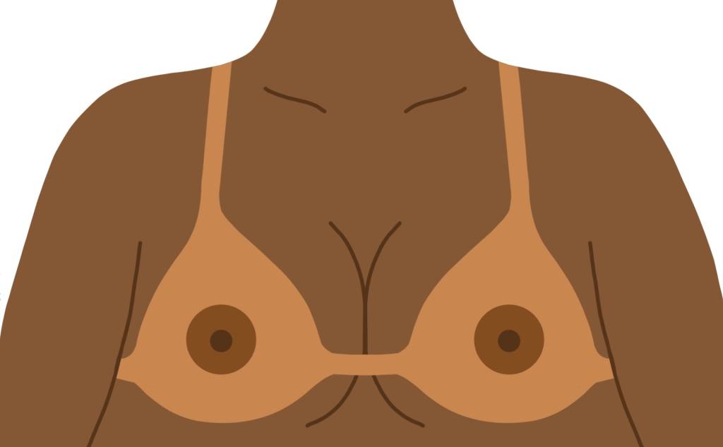 Largados, pelados e queimados de sol